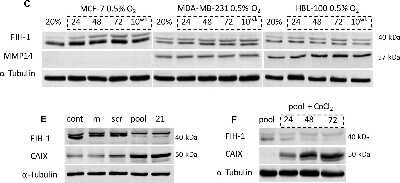 Knockdown Validated: FIH-1/HIF-1AN Antibody [NB100-428]